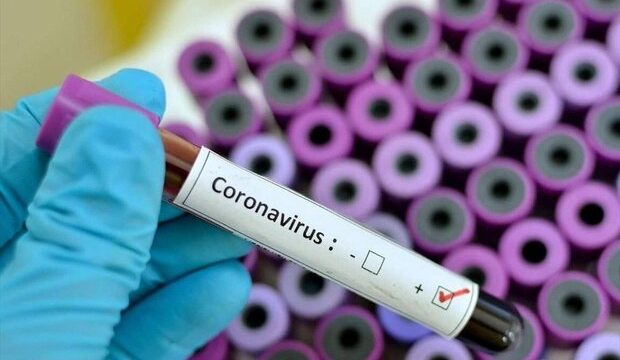 Iran’s import of COVID19 test kits hampered by US