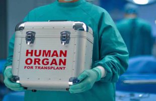 In first, organ transplants from deceased patients performed in Iran, Middle East: Report
